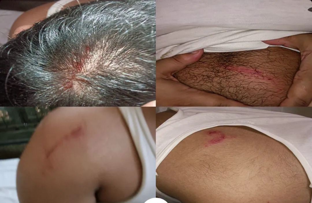 কুড়িগ্রামে ইসলামী ছাত্রশিবির পলিটেকনিক সভাপতির উপর ছাত্রদলের হামলা 