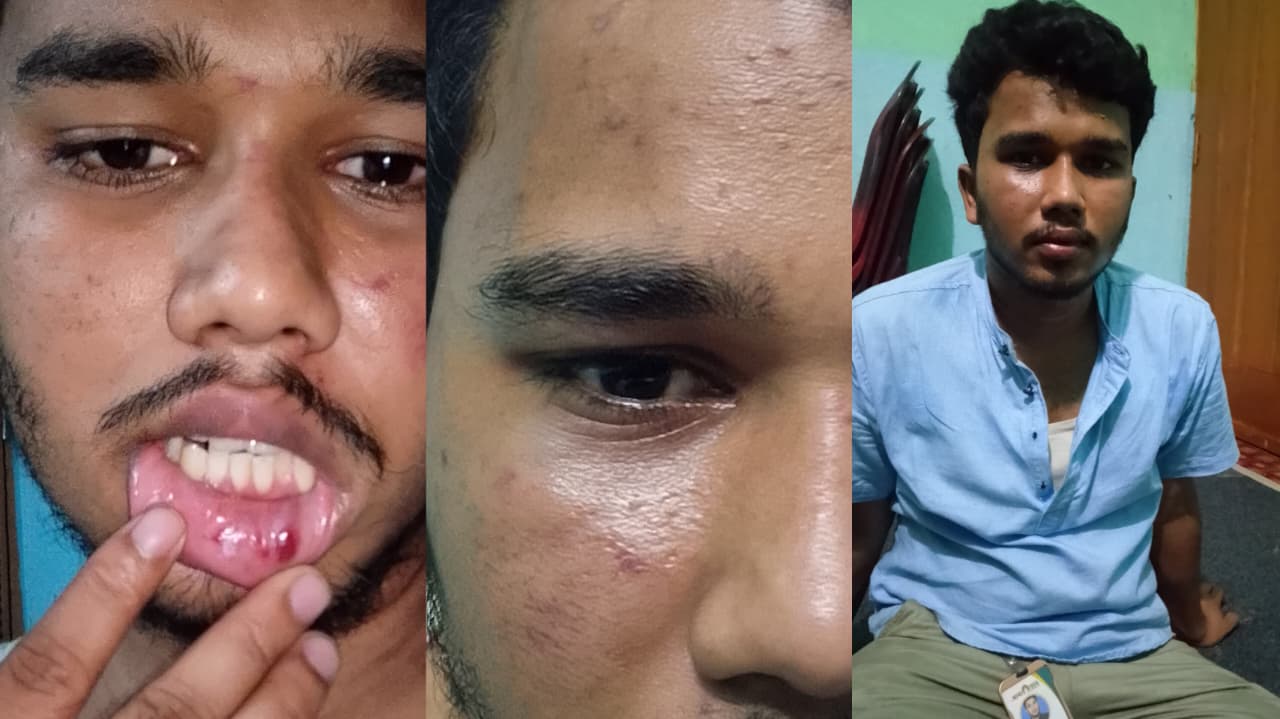 রায়পুরে সাংবাদিকের ওপর হামলা, পেশাগত দায়িত্ব পালনে বাধা, ও তথ্য মুছে ফেলার অভিযোগ